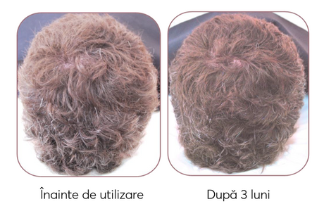 Ser impotriva incaruntirii si caderii parului Ageless Clinic Ampoule, Rut Hair, 100 ml