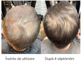 Ser impotriva incaruntirii si caderii parului Ageless Clinic Ampoule, Rut Hair, 100 ml